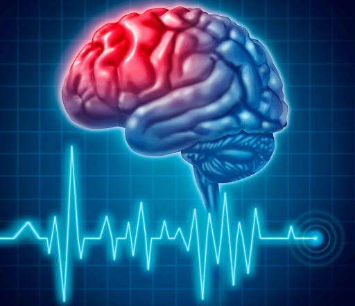 Що таке інсульт та як його розпізнати?